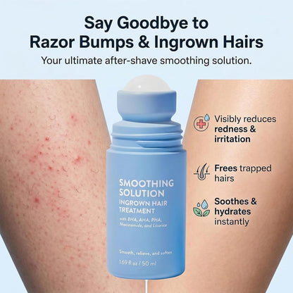 Smooth Ingrown Hair Treatment Solution US